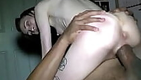 Consumptive Girl Fucks A Fence Post