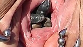 Progressive Fisting Huge Anal Objects and Japanese Weird Overcrowd