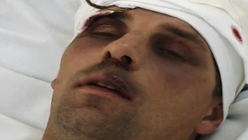 Katja Kean's erotic encounter with patient in HD