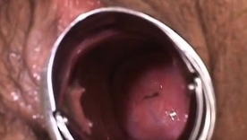 Misato Kuninaka, a naughty nurse, gets naughty with medical toys