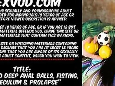 Hotkinkyjo deep anal balls fisting XO speculum  prolapse