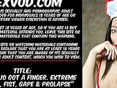 Hotkinkyjo got finger Anal Fisting prolapse gape belly bulge